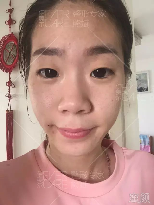 https://img.miyanlife.com/mnt/timg/180822/11554261G-9.jpg