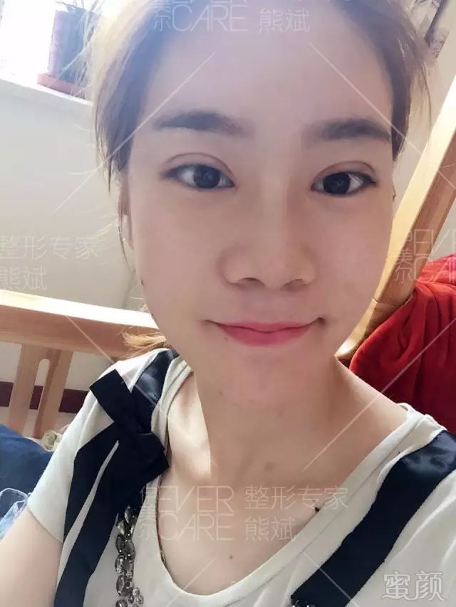 https://img.miyanlife.com/mnt/timg/180822/11554323X-11.jpg