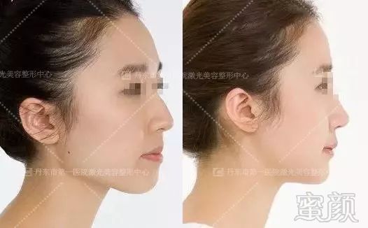 https://img.miyanlife.com/mnt/timg/180822/115RQ558-5.jpg