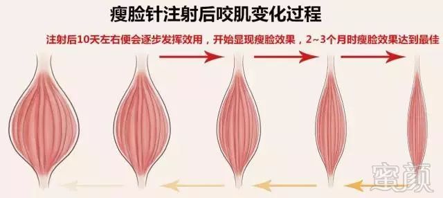 https://img.miyanlife.com/mnt/timg/180822/115RS213-3.jpg