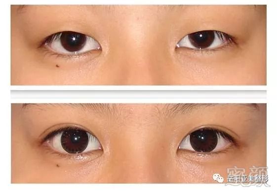 https://img.miyanlife.com/mnt/timg/180822/120RR237-4.jpg