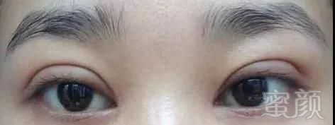 https://img.miyanlife.com/mnt/timg/180822/120RRK2-3.jpg
