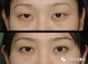 https://img.miyanlife.com/mnt/timg/180822/120Ra9C-5.jpg
