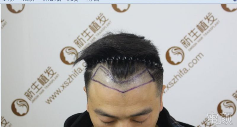 https://img.miyanlife.com/mnt/timg/180822/12114T413-3.jpg