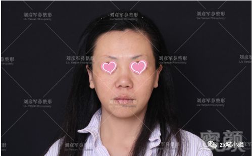 https://img.miyanlife.com/mnt/timg/180822/1230332624-0.jpg