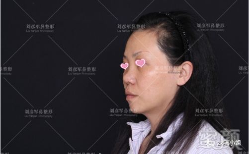 https://img.miyanlife.com/mnt/timg/180822/123033I37-1.jpg
