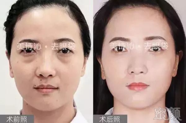 https://img.miyanlife.com/mnt/timg/180822/1231012516-6.jpg