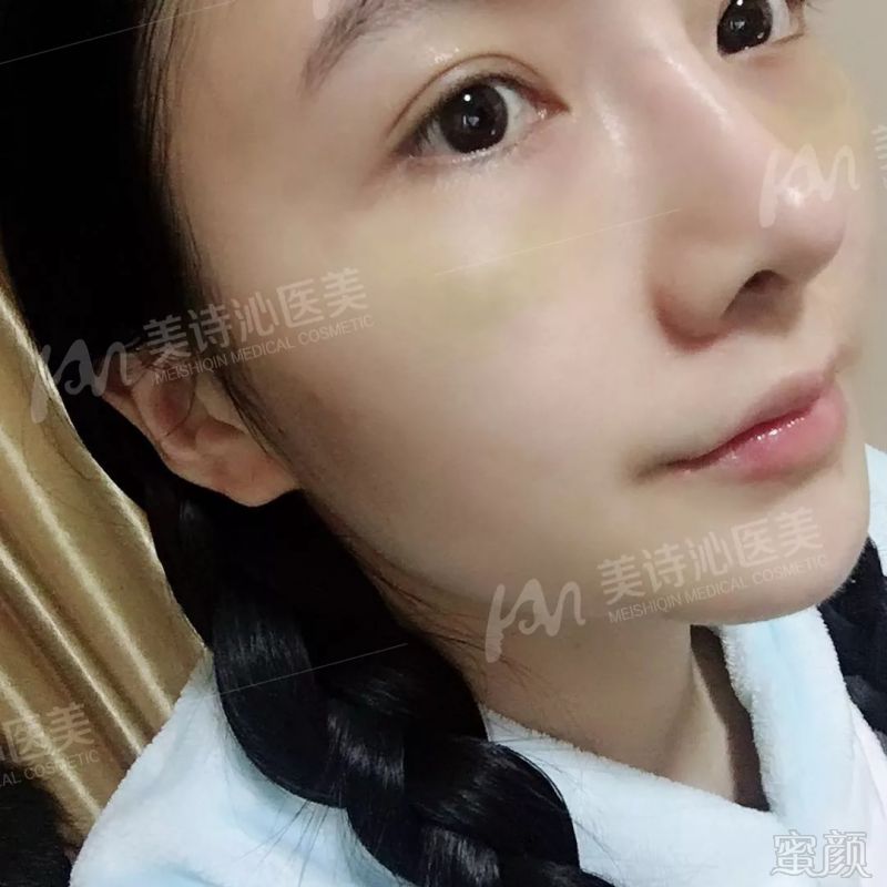 https://img.miyanlife.com/mnt/timg/180822/1231043W6-11.jpg