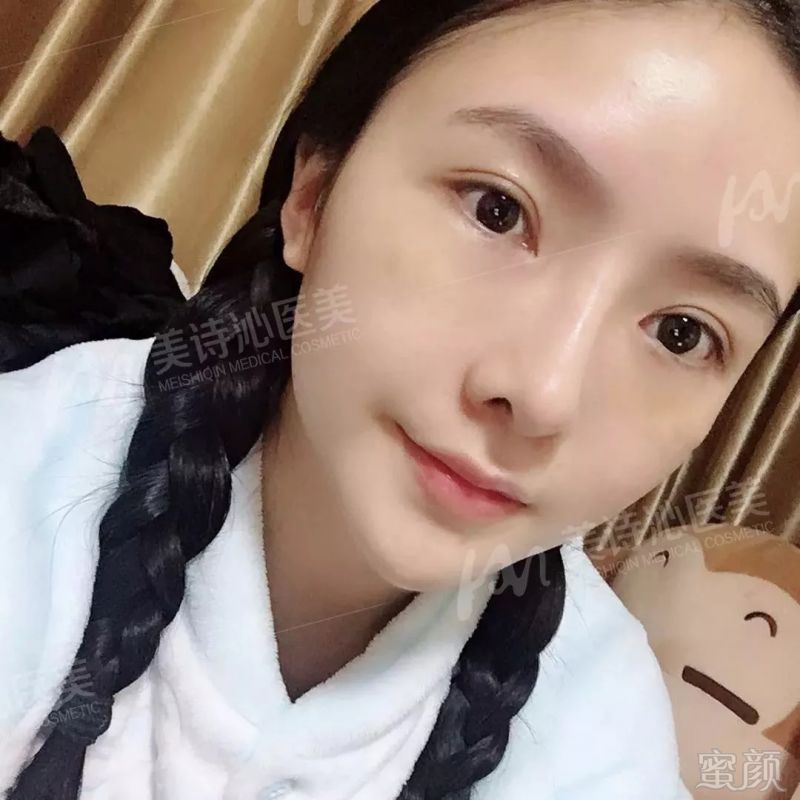 https://img.miyanlife.com/mnt/timg/180822/12310564A-12.jpg