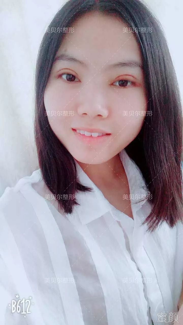 https://img.miyanlife.com/mnt/timg/180822/1233596200-2.jpg