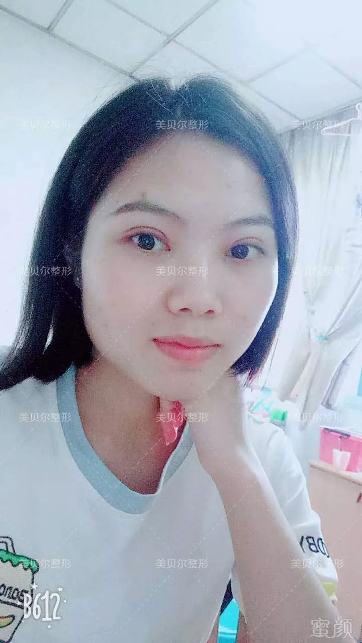 https://img.miyanlife.com/mnt/timg/180822/1234003P1-5.jpg