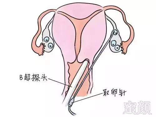 https://img.miyanlife.com/mnt/timg/180822/12493TG6-2.jpg