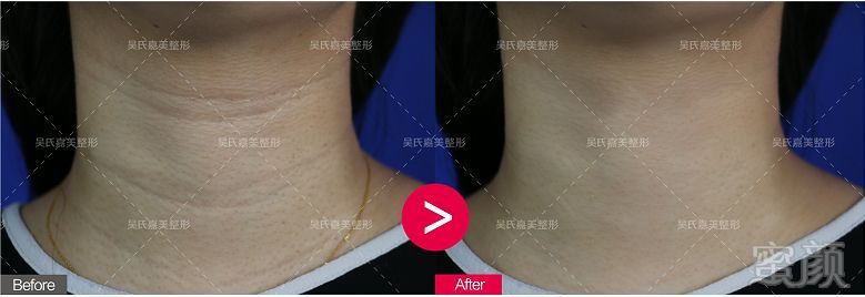 https://img.miyanlife.com/mnt/timg/180822/12594Kb2-7.jpg