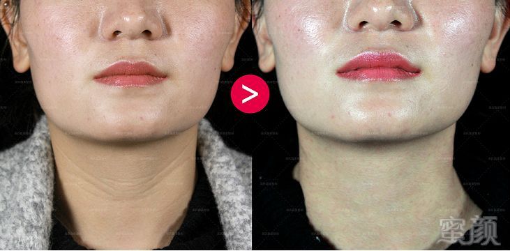 https://img.miyanlife.com/mnt/timg/180822/12594L413-8.jpg