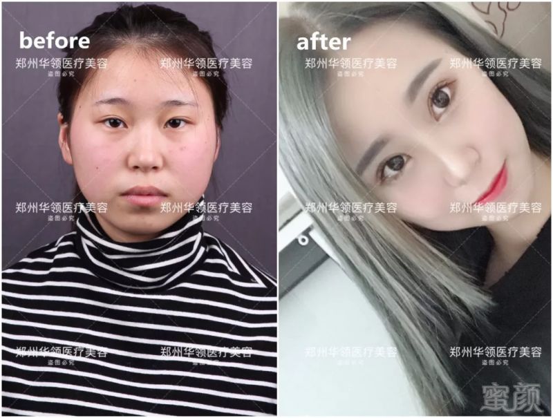 https://img.miyanlife.com/mnt/timg/180822/13043LV1-8.jpg