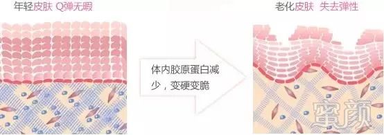 https://img.miyanlife.com/mnt/timg/180822/1311555234-6.jpg