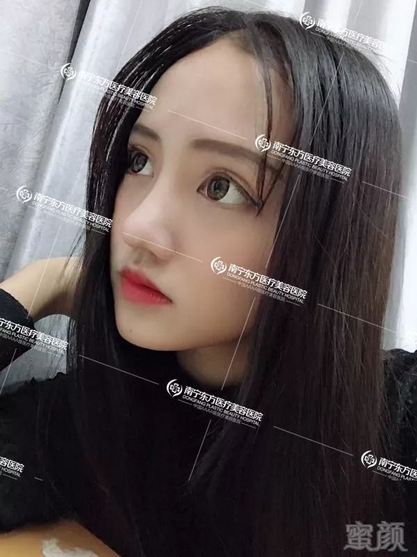 https://img.miyanlife.com/mnt/timg/180822/1313111158-0.jpg