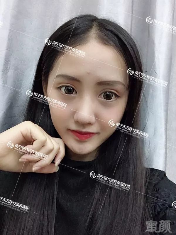 https://img.miyanlife.com/mnt/timg/180822/1313114547-1.jpg