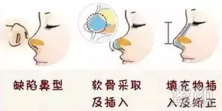 https://img.miyanlife.com/mnt/timg/180822/1313154K0-8.jpg