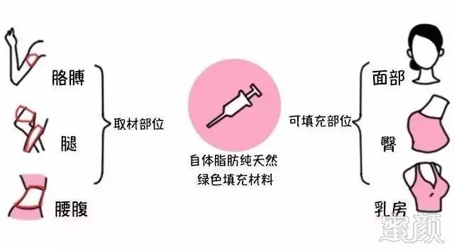 https://img.miyanlife.com/mnt/timg/180823/11105LF3-2.jpg
