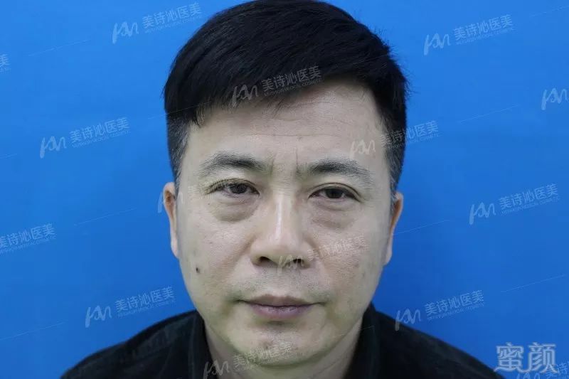 https://img.miyanlife.com/mnt/timg/180823/1112022V1-2.jpg