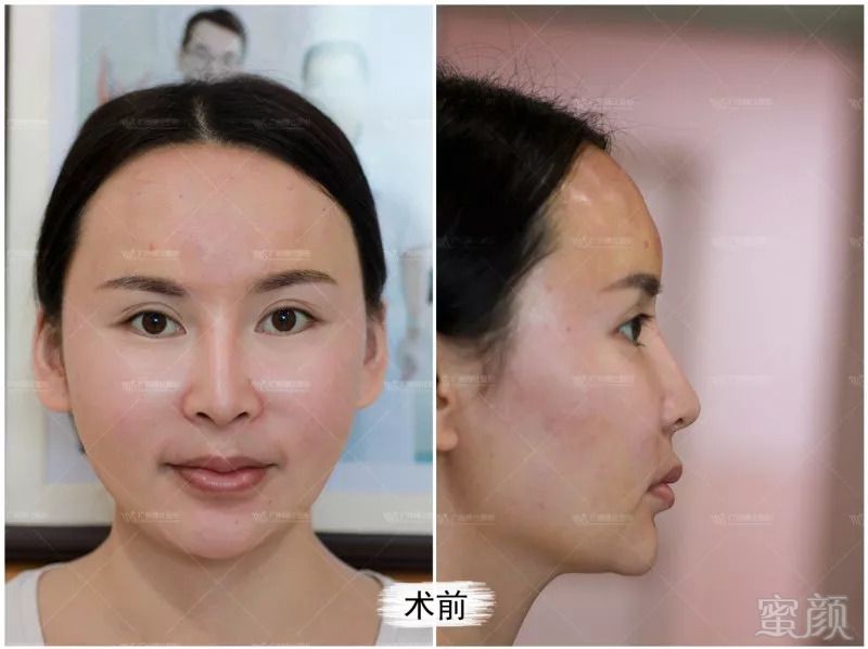 https://img.miyanlife.com/mnt/timg/180823/11152R0N-0.jpg