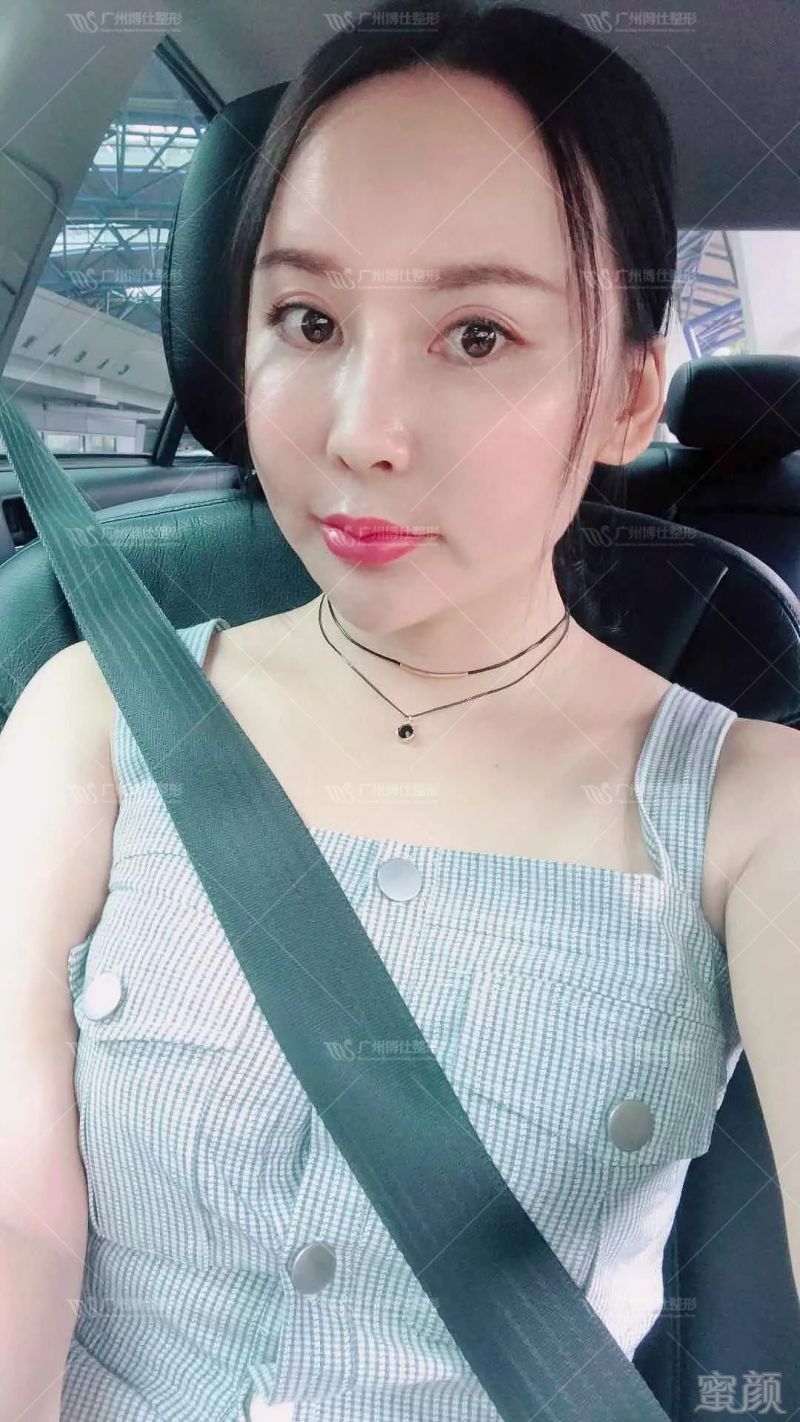 https://img.miyanlife.com/mnt/timg/180823/11153052V-3.jpg