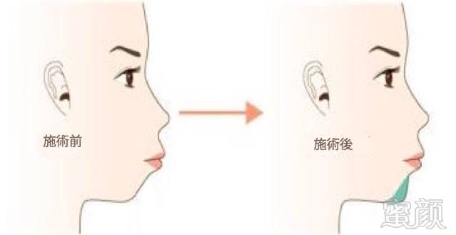 https://img.miyanlife.com/mnt/timg/180823/11250Hb4-3.jpg