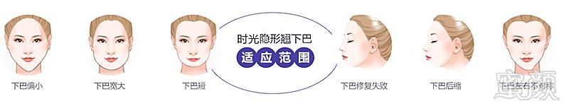 https://img.miyanlife.com/mnt/timg/180823/11250V118-7.jpg