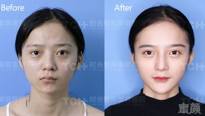 https://img.miyanlife.com/mnt/timg/180823/11250a0I-13.jpg