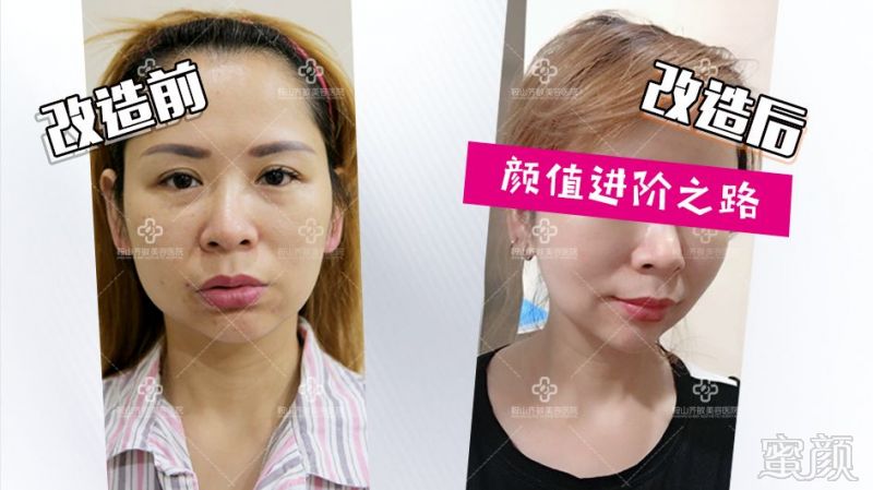 https://img.miyanlife.com/mnt/timg/180823/112F52395-1.jpg