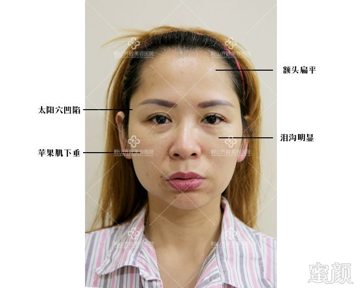 https://img.miyanlife.com/mnt/timg/180823/112F63216-2.jpg