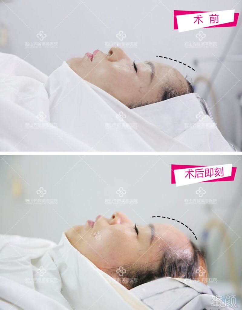 https://img.miyanlife.com/mnt/timg/180823/112FS060-5.jpg