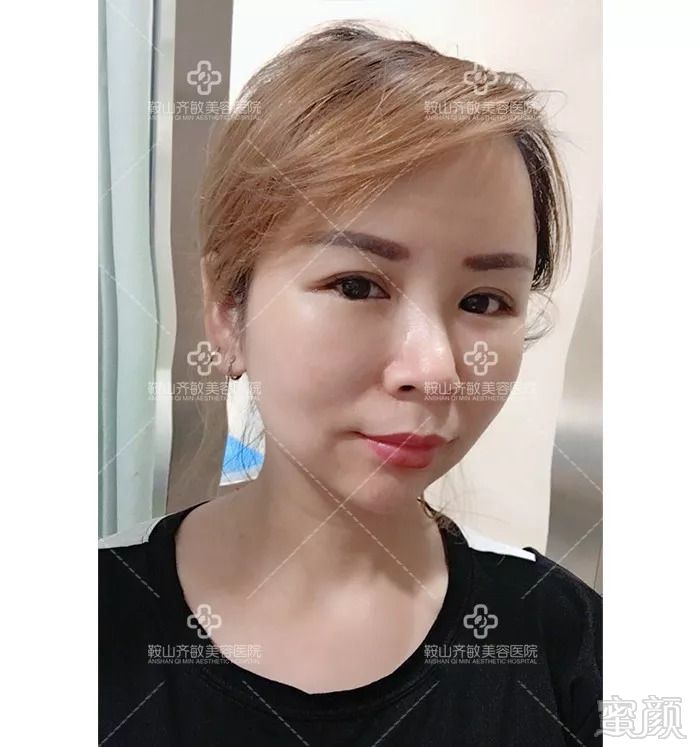 https://img.miyanlife.com/mnt/timg/180823/112G1GC-7.jpg