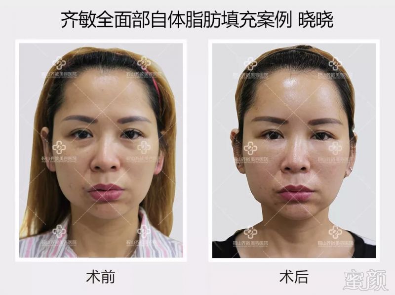 https://img.miyanlife.com/mnt/timg/180823/112G2H41-8.jpg