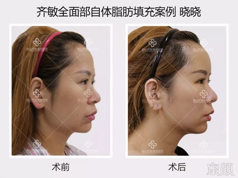 https://img.miyanlife.com/mnt/timg/180823/112G54295-9.jpg