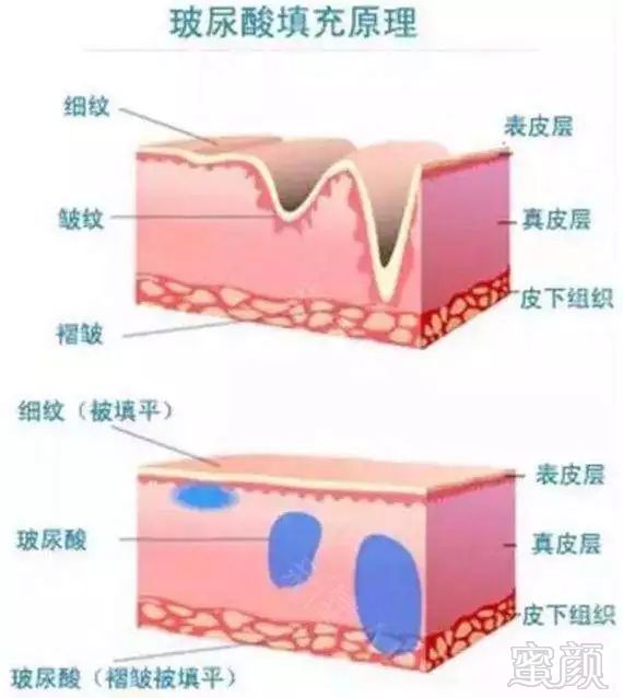 案例图片