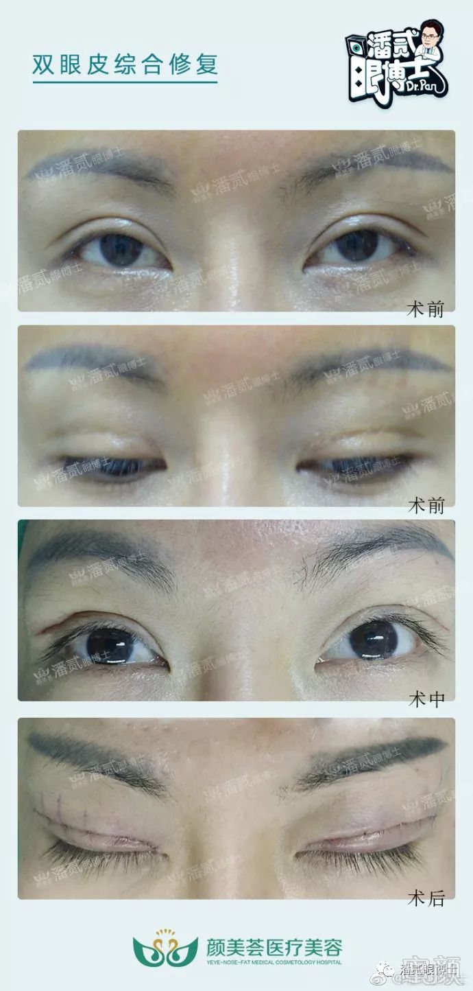 https://img.miyanlife.com/mnt/timg/180823/1140411141-0.jpg