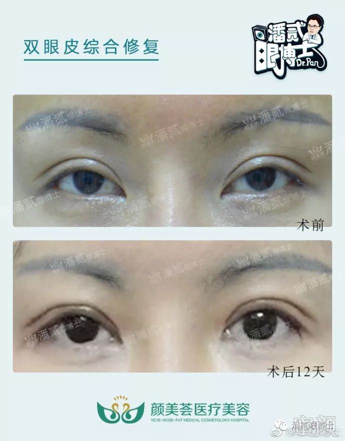 https://img.miyanlife.com/mnt/timg/180823/1140453145-1.jpg