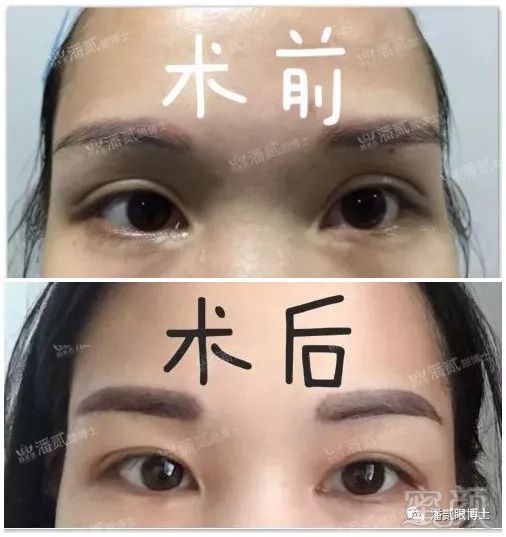 https://img.miyanlife.com/mnt/timg/180823/11404SG7-3.jpg