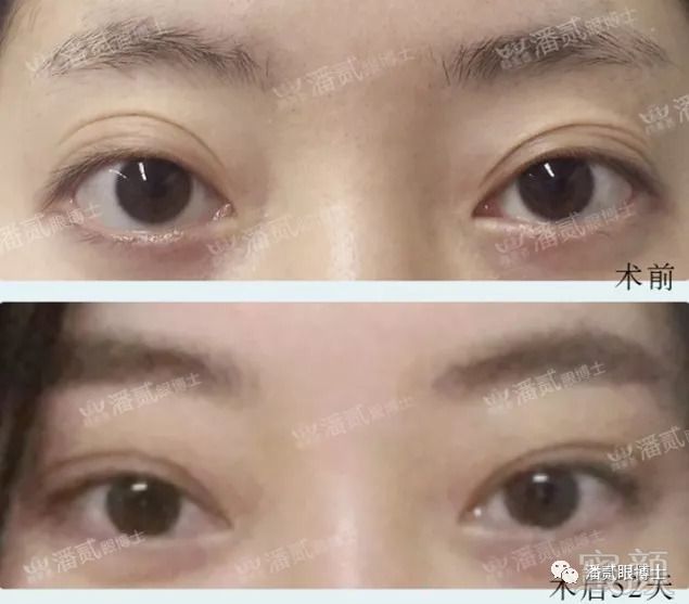 https://img.miyanlife.com/mnt/timg/180823/11405055V-4.jpg