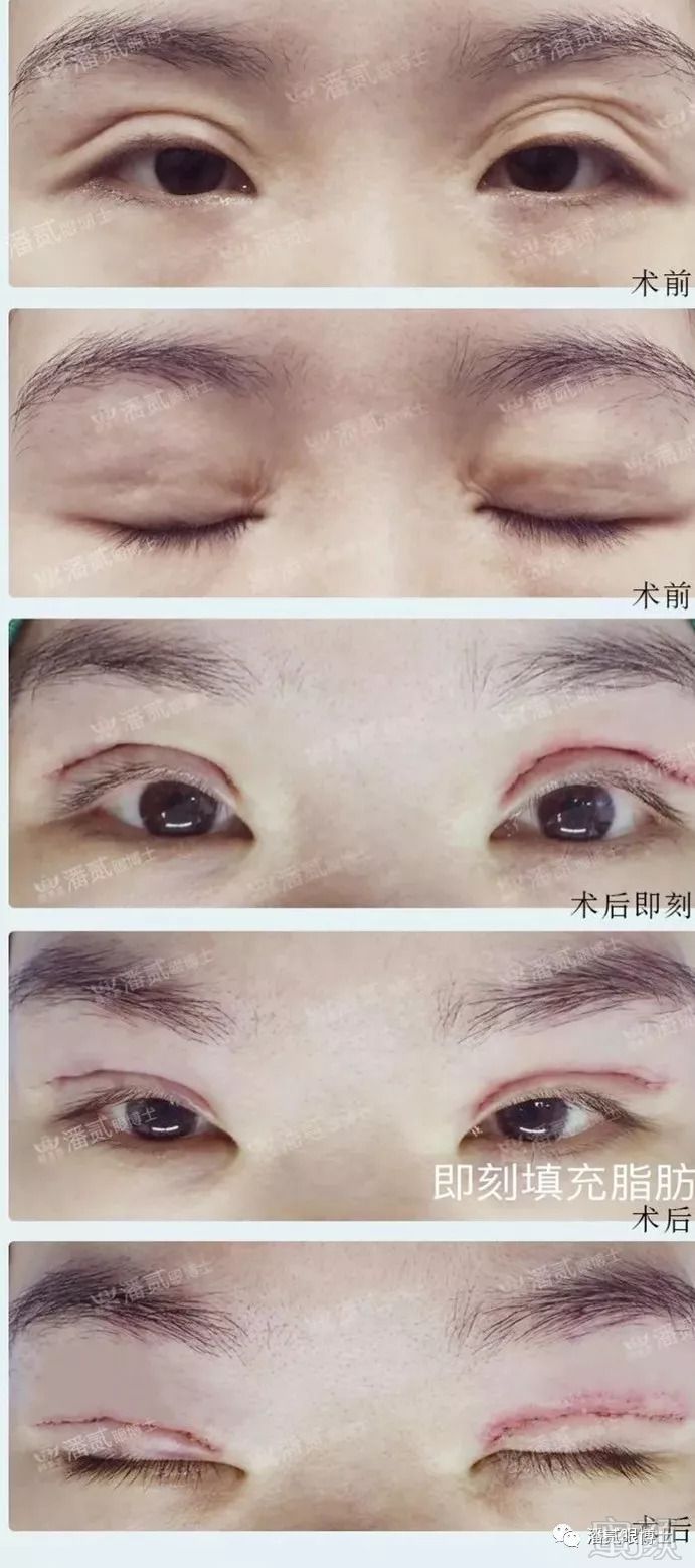 https://img.miyanlife.com/mnt/timg/180823/114055N25-8.jpg
