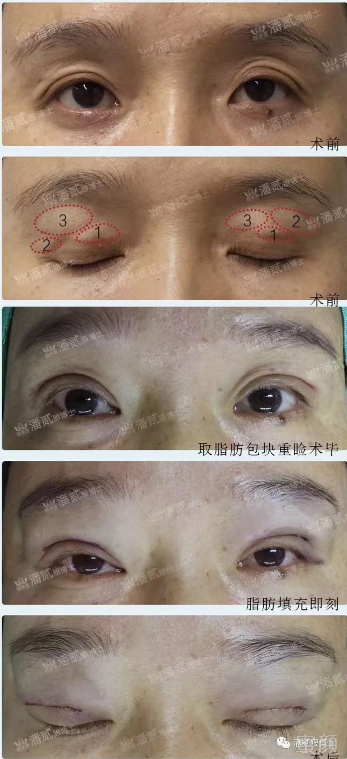https://img.miyanlife.com/mnt/timg/180823/11405915F-10.jpg
