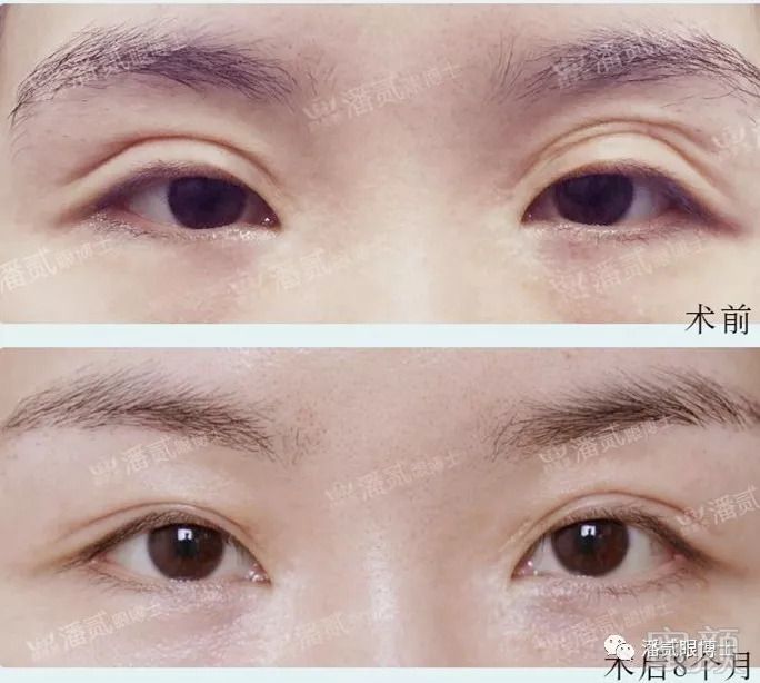 https://img.miyanlife.com/mnt/timg/180823/11405W555-9.jpg