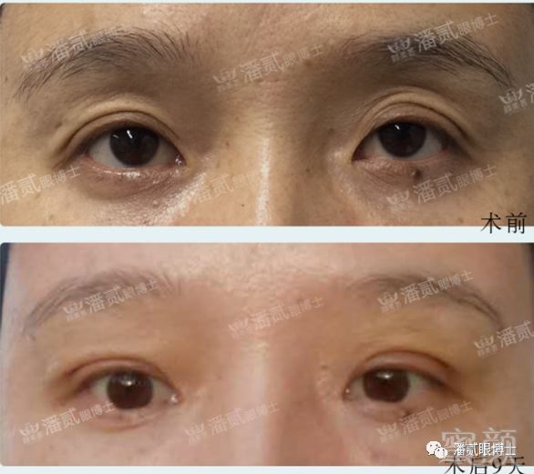 https://img.miyanlife.com/mnt/timg/180823/1141023S7-11.jpg