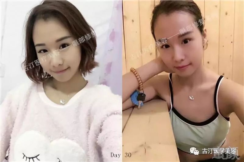https://img.miyanlife.com/mnt/timg/180823/1153291101-8.jpg
