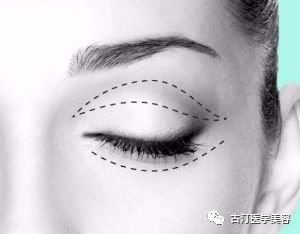 https://img.miyanlife.com/mnt/timg/180823/11532Q103-3.jpg