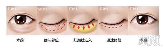 https://img.miyanlife.com/mnt/timg/180823/12313Q613-7.jpg
