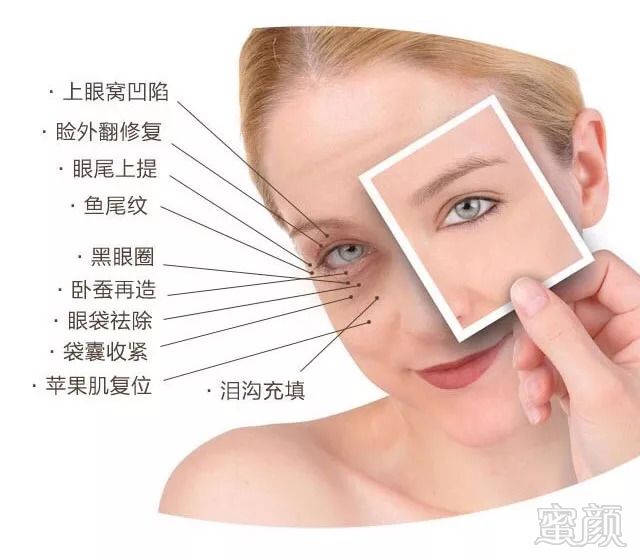 https://img.miyanlife.com/mnt/timg/180823/12313V2c-9.jpg