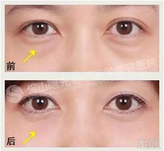 https://img.miyanlife.com/mnt/timg/180823/12313W9B-8.jpg